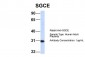 SGCE antibody - N-terminal region